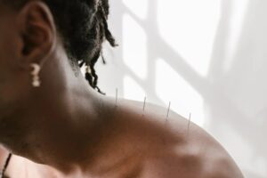 Acupuncture Safe During Pregnancy